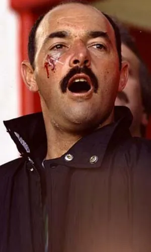 Bruce Grobbelaar